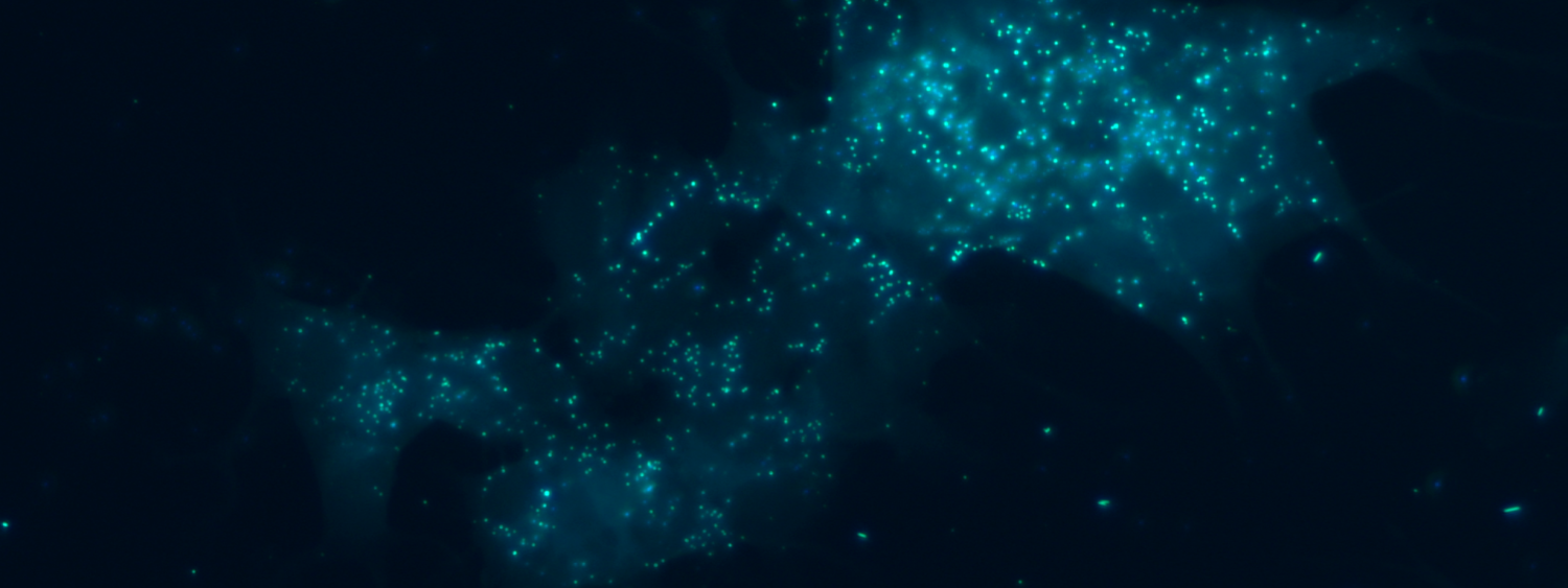 Foto di cellule neuronali