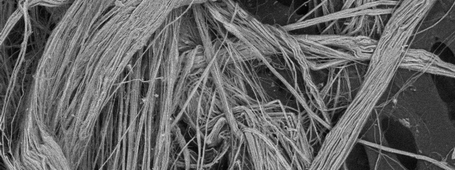 foto SEM fibre di amianto