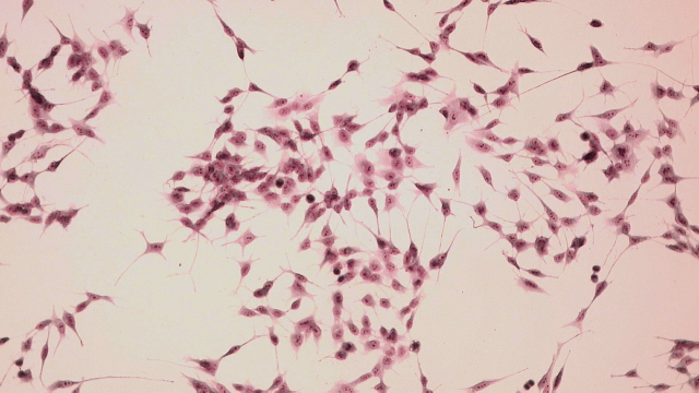 Foto di cellule neuronali umane